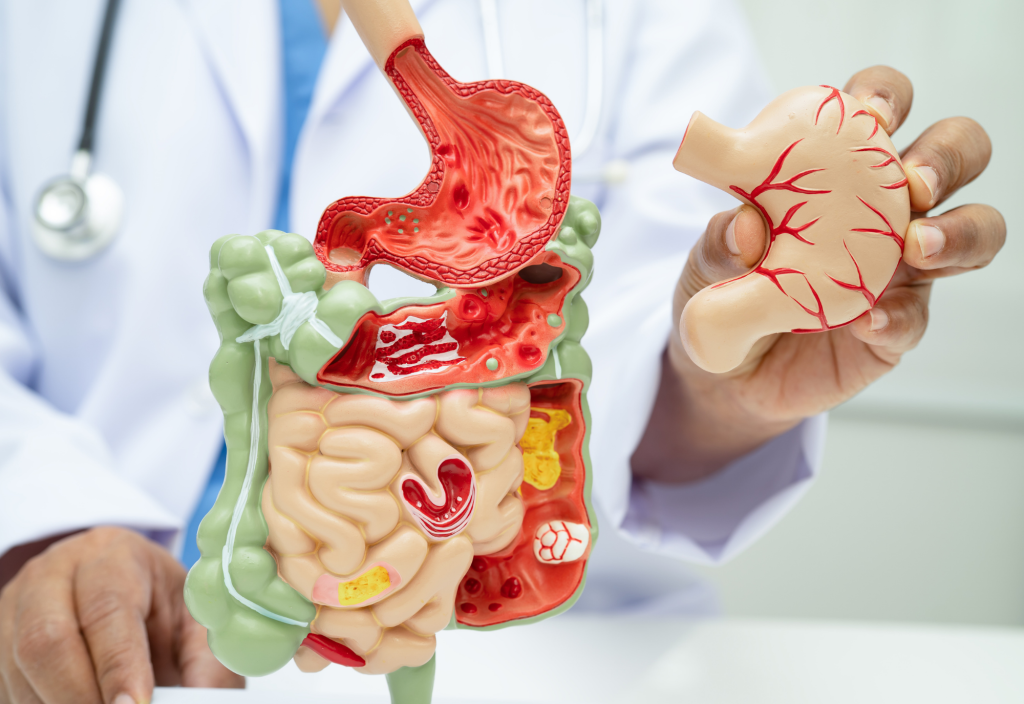 Apa Itu Gut Health dan Kenapa Penting untuk Tubuh? apa itu gut health dan kenapa penting untuk tubuh
